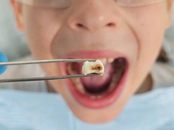 Best Emergency Broken Tooth Repair in Newark, NJ